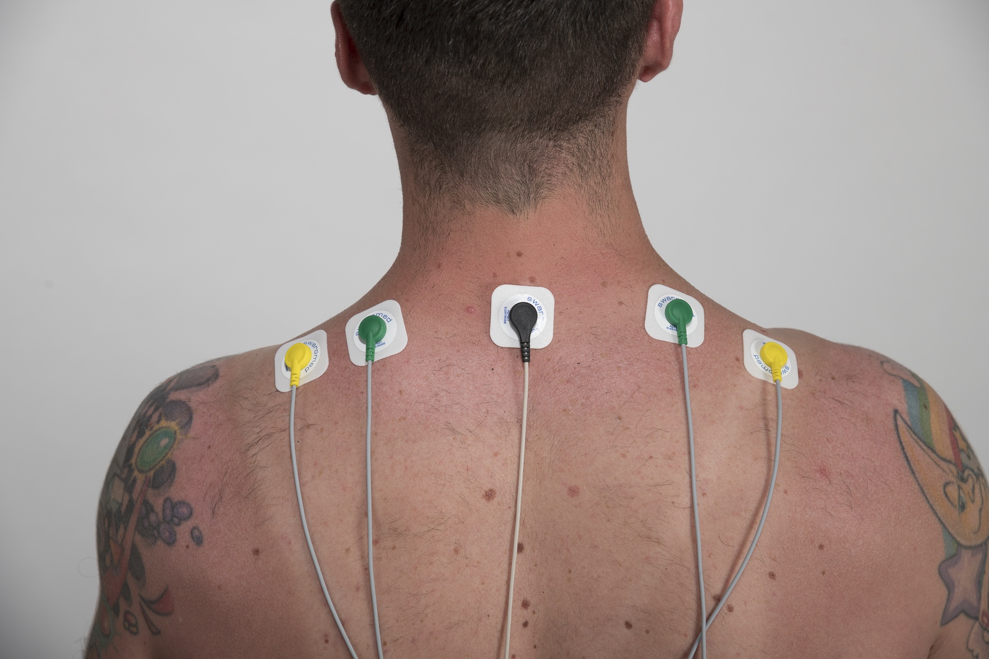 Biofeedback Sport: Anbringung von EMG-Elektroden auf dem Trapezius beim Biofeedback